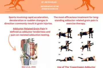 Groin Pain: Into the Bermuda Triangle (Part 1) Diagnosing, managing & rehabilitating injuries in the Bermuda triangle By Jim Scanlan, Infographic by Dr. Jennifer Duncan Sports involving rapid acceleration, deceleration or sudden changes in direction commonly result in groin injuries. Adductor Related Groin Pain Defined as adductor tenderness and pain on resisted adduction testing. The most efficacious treatment for long-standing adductor related groin pain is exercise therapy. Exercise illustrations (1A, 1B, 2A, 2B, 3A, 3B) The Copenhagen ‘Hip and Groin Outcome Score’ (HAGOS) Patient-reported outcome measure to monitor long-standing groin pain rehabilitation. Use of the ‘Copenhagen Adductor Exercise Protocol’ Reduces prevalence and risk of groin pain across a variety of groin pain diagnoses.