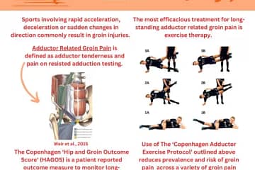 Groin Pain: Into the Bermuda Triangle (Part 1) Diagnosing, managing & rehabilitating injuries in the Bermuda triangle By Jim Scanlan, Infographic by Dr. Jennifer Duncan Sports involving rapid acceleration, deceleration or sudden changes in direction commonly result in groin injuries. Adductor Related Groin Pain Defined as adductor tenderness and pain on resisted adduction testing. The most efficacious treatment for long-standing adductor related groin pain is exercise therapy. Exercise illustrations (1A, 1B, 2A, 2B, 3A, 3B) The Copenhagen ‘Hip and Groin Outcome Score’ (HAGOS) Patient-reported outcome measure to monitor long-standing groin pain rehabilitation. Use of the ‘Copenhagen Adductor Exercise Protocol’ Reduces prevalence and risk of groin pain across a variety of groin pain diagnoses.